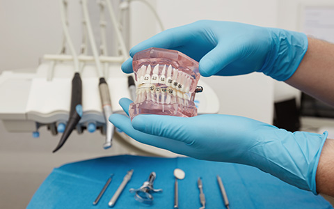Üsküdar Ortodonti Tedavisi - Dentalzone