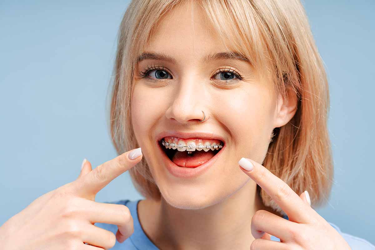Üsküdar Lingual Ortodonti Tedavisi - Dentalzone Diş Kliniği